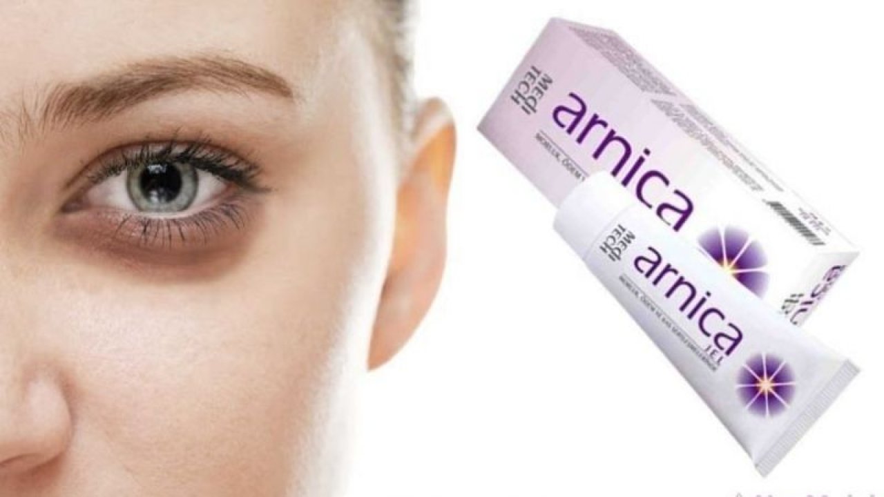 Arnica Krem ve Jel Arasındaki Farkların Ayrıntılı İncelemesi