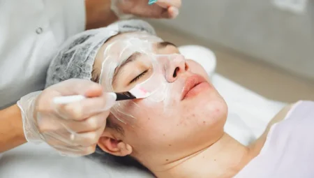 Kimyasal Peeling Nedir? Faydaları Nelerdir?