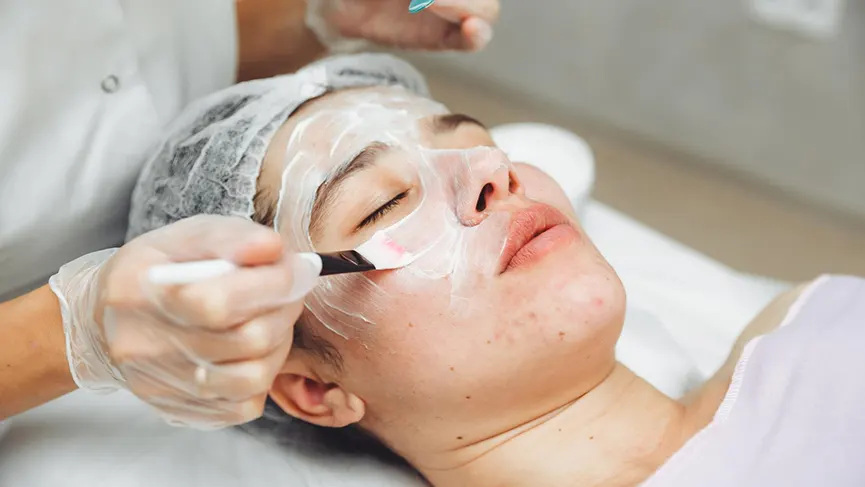 Kimyasal Peeling Nedir? Faydaları Nelerdir?