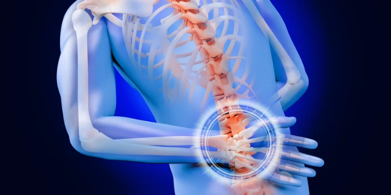 Servikal Spondiloz Nedir ve Neden Olur?