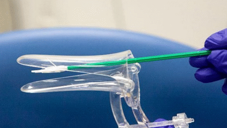 Smear Testi Nedir? Ne Zaman Yapılmalı?