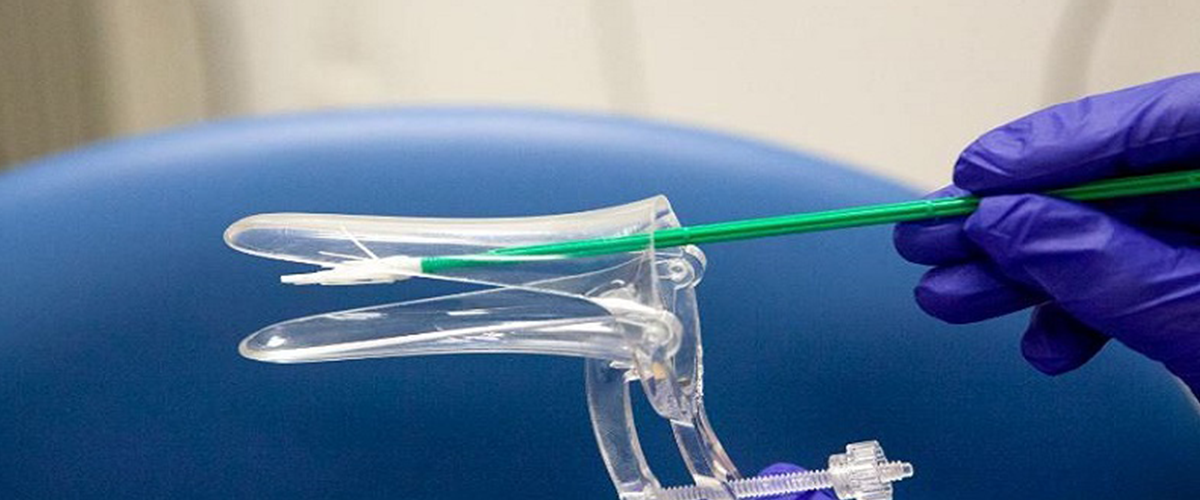 Smear Testi Nedir? Ne Zaman Yapılmalı?