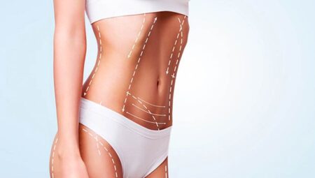 Vaser Liposuction Nedir? Avantajları Nelerdir?