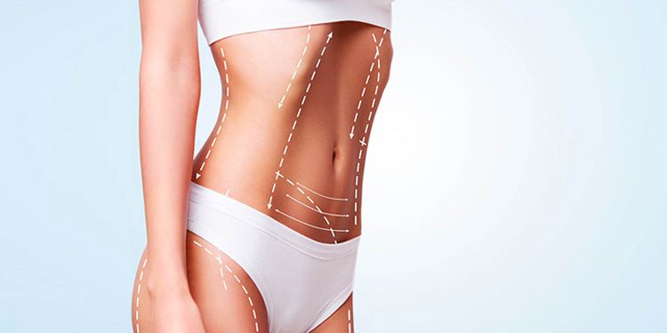 Vaser Liposuction Nedir?