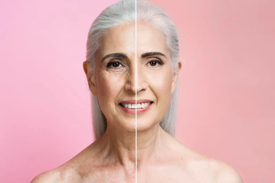 Anti-Aging Nedir? Anti-Aging Cilt Bakımı Nasıl Uygulanır?