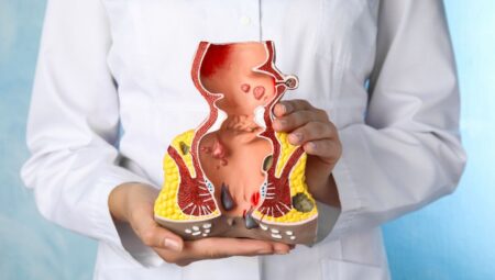 Basur (Hemoroid) Nedir? Neden Olur? Belirtileri ve Tedavi Yöntemleri