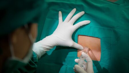 Epidural Anestezi Nedir? Nasıl Uygulanır?