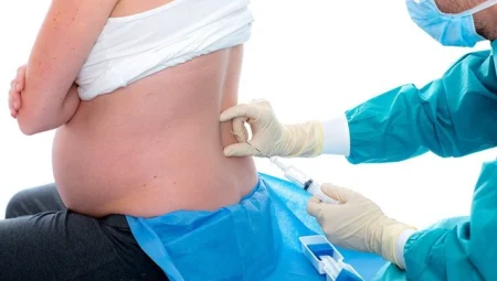 Epidural Doğum Nedir? Epidural Doğumun Avantajları Nelerdir?
