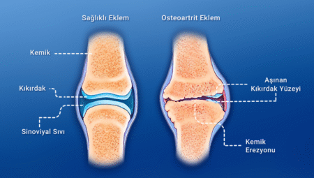 Kemik ve Eklem Sağlığı Hakkında Merak Edilenler