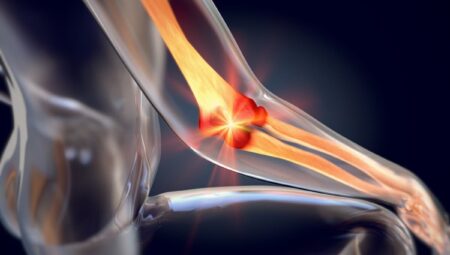 Osteogenezis Imperfekta Nedir? Neden Olur? Belirtileri Ve Tedavi Yöntemleri Nelerdir?