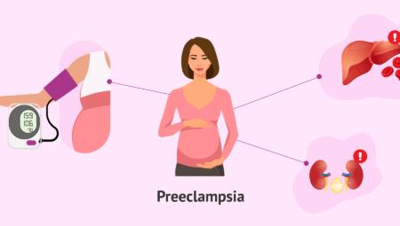 Preeklampsi Nedir? Belirtileri ve Tedavi Yöntemleri