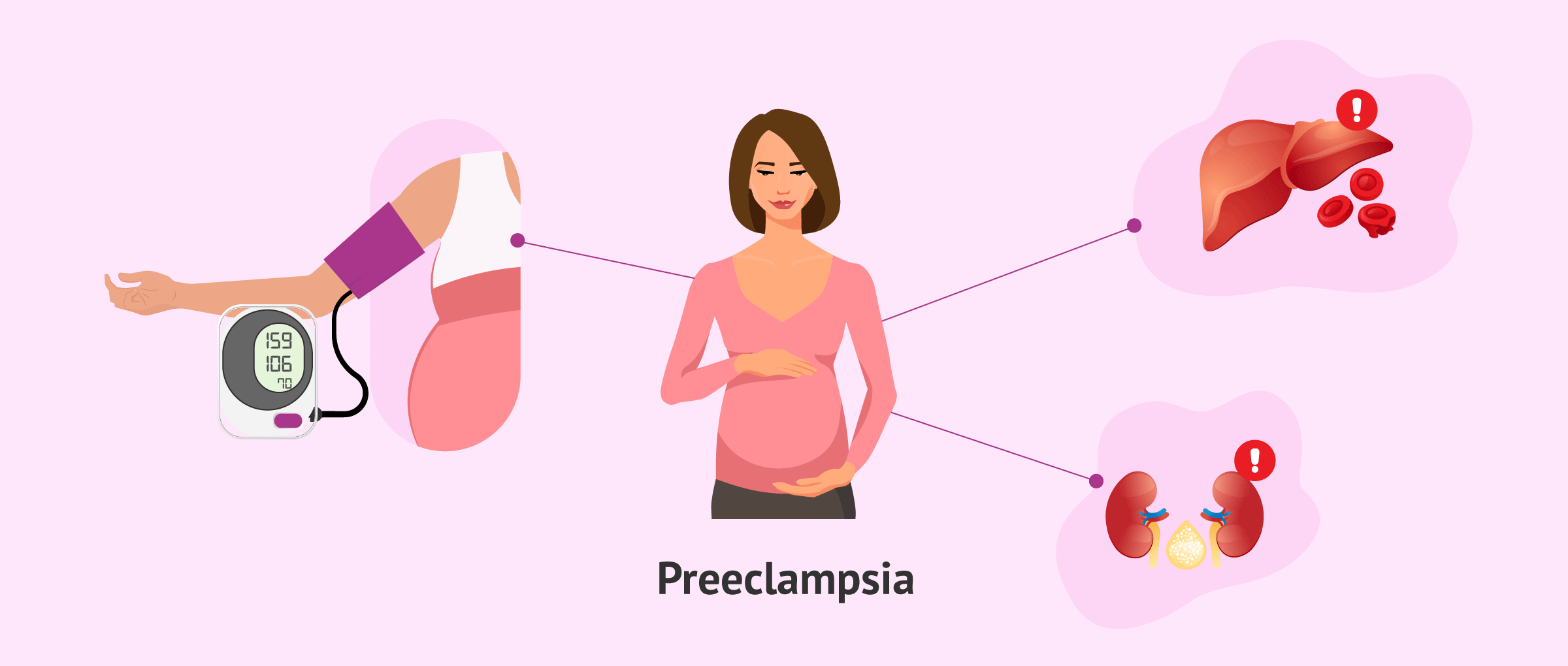 Preeklampsi Nedir? Belirtileri ve Tedavi Yöntemleri