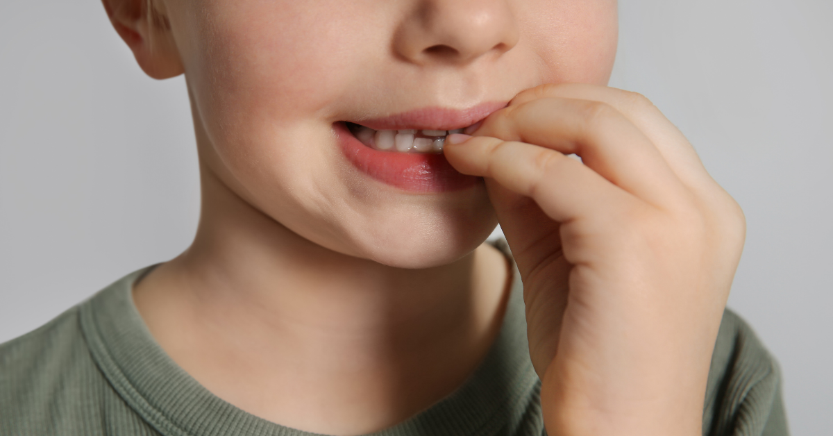 Tırnak Yeme Alışkanlığı Nedir? Tırnak Yeme Nasıl Bırakılır?