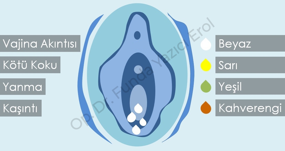 Kokulu Akıntının Sebebi Nedir? Vakinal Akıntı Nasıl Geçer?