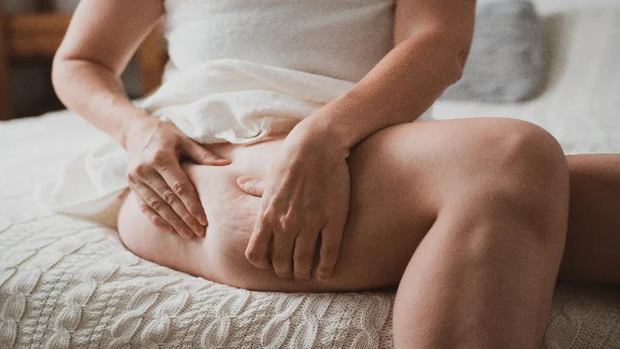 Selülit Nedir, Belirtileri, Nedenleri ve Tedavi Yöntemleri