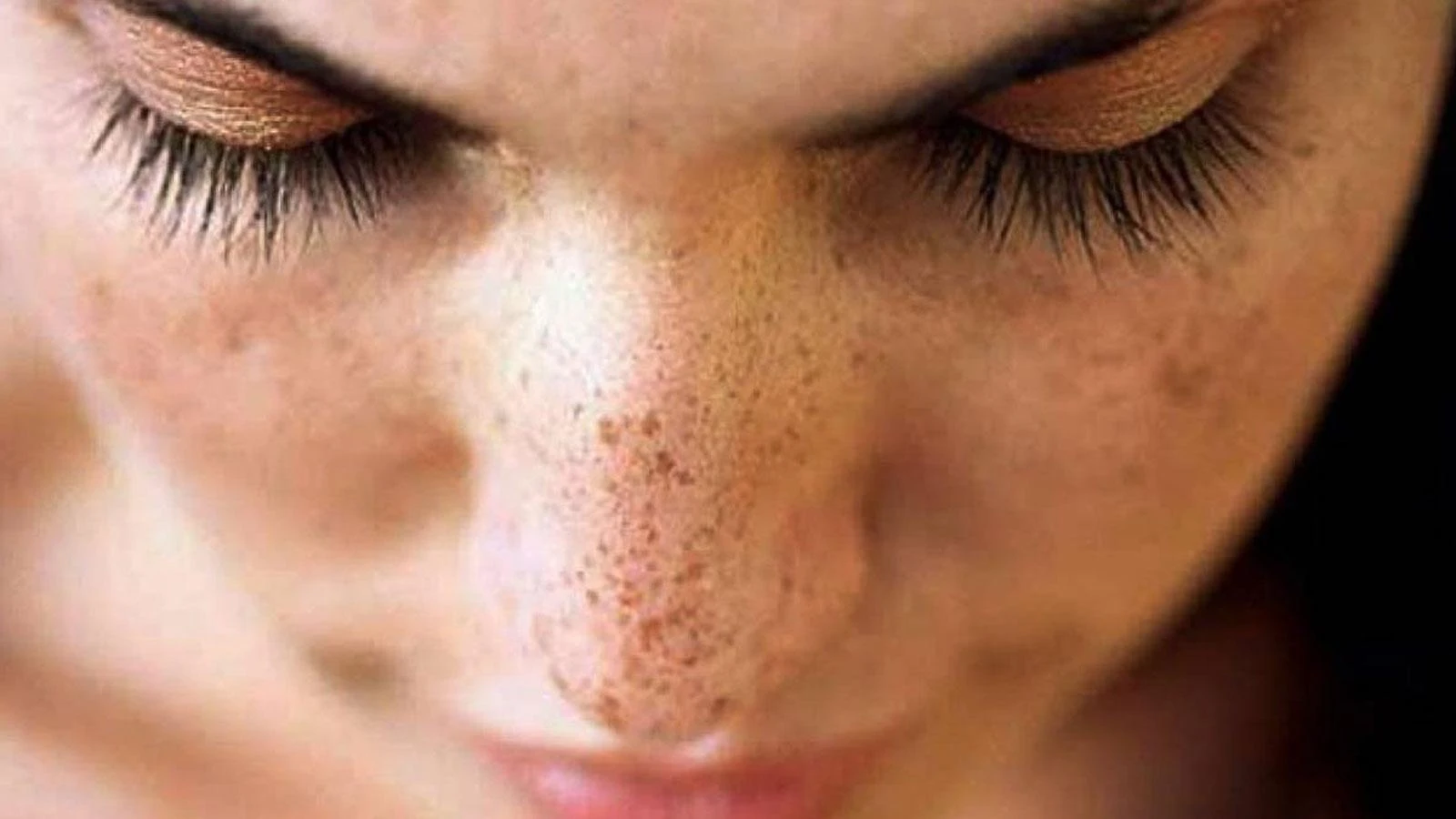 Çillerden Kurtulmak İçin Doğal Maskeler