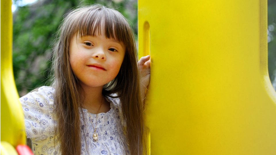 Down Sendromu Belirtileri Nelerdir?